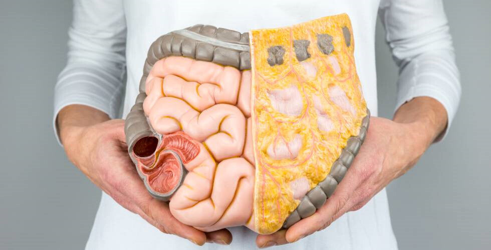 Enfermedad inflamatoria intestinal. Terapia nutricional